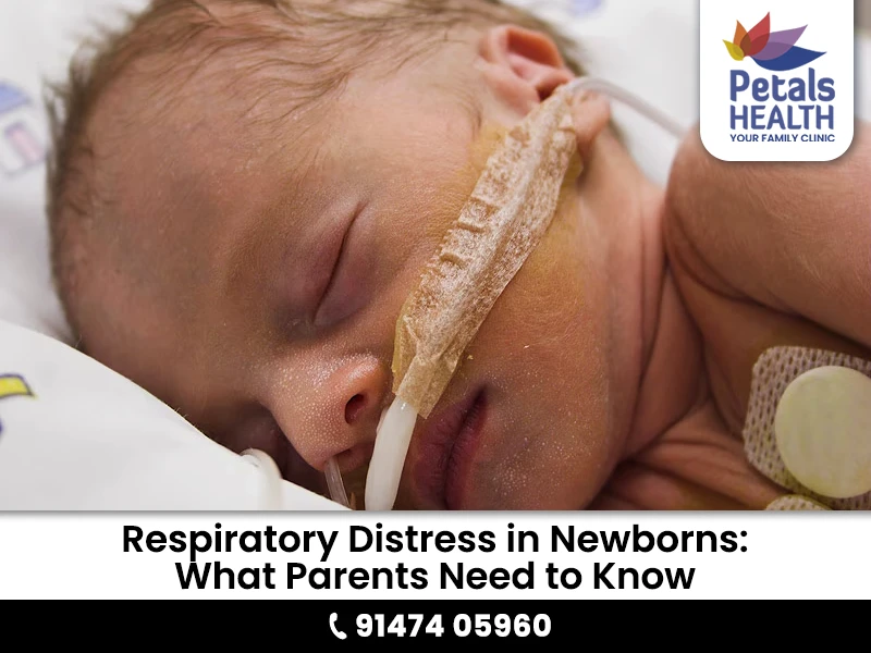  What to Do If Your Baby Has Trouble Breathing After Birth