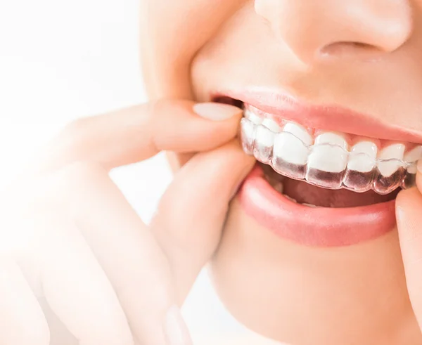 The Importance of Dental Hygiene and Teeth Whitening at Pinner Green Dental Clinic