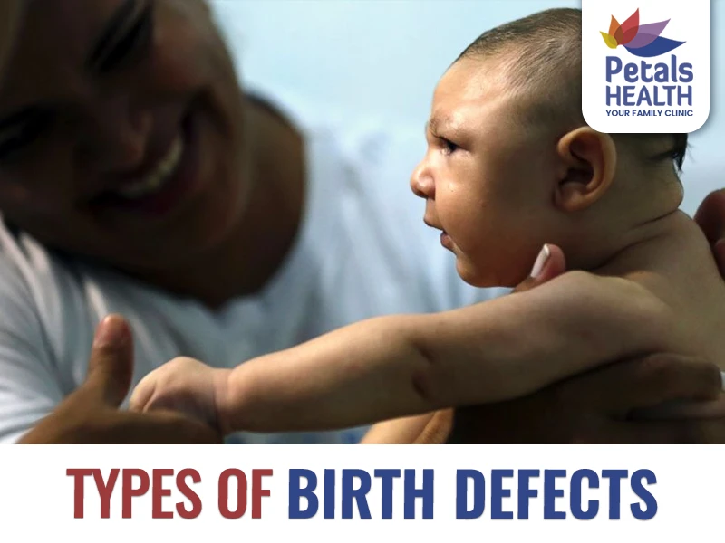 Understanding the Different Types of Birth Defects