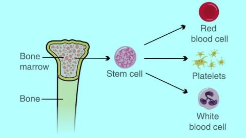 Bone Marrow / Stem Cell Transplantation: A Lifesaving Treatment for Blood Disorders and Cancers