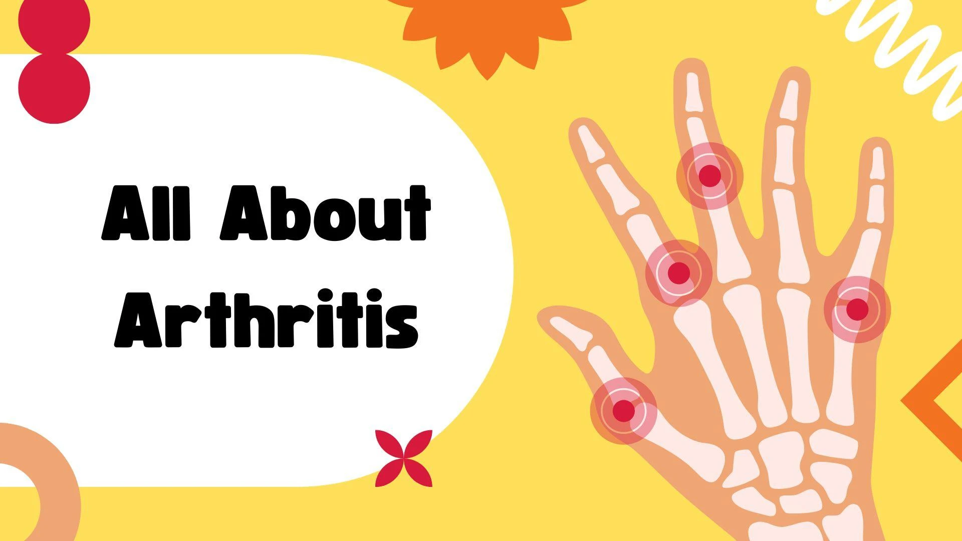 What Is Rheumatoid Arthritis? Causes, Symptoms, and Treatments You Should Know