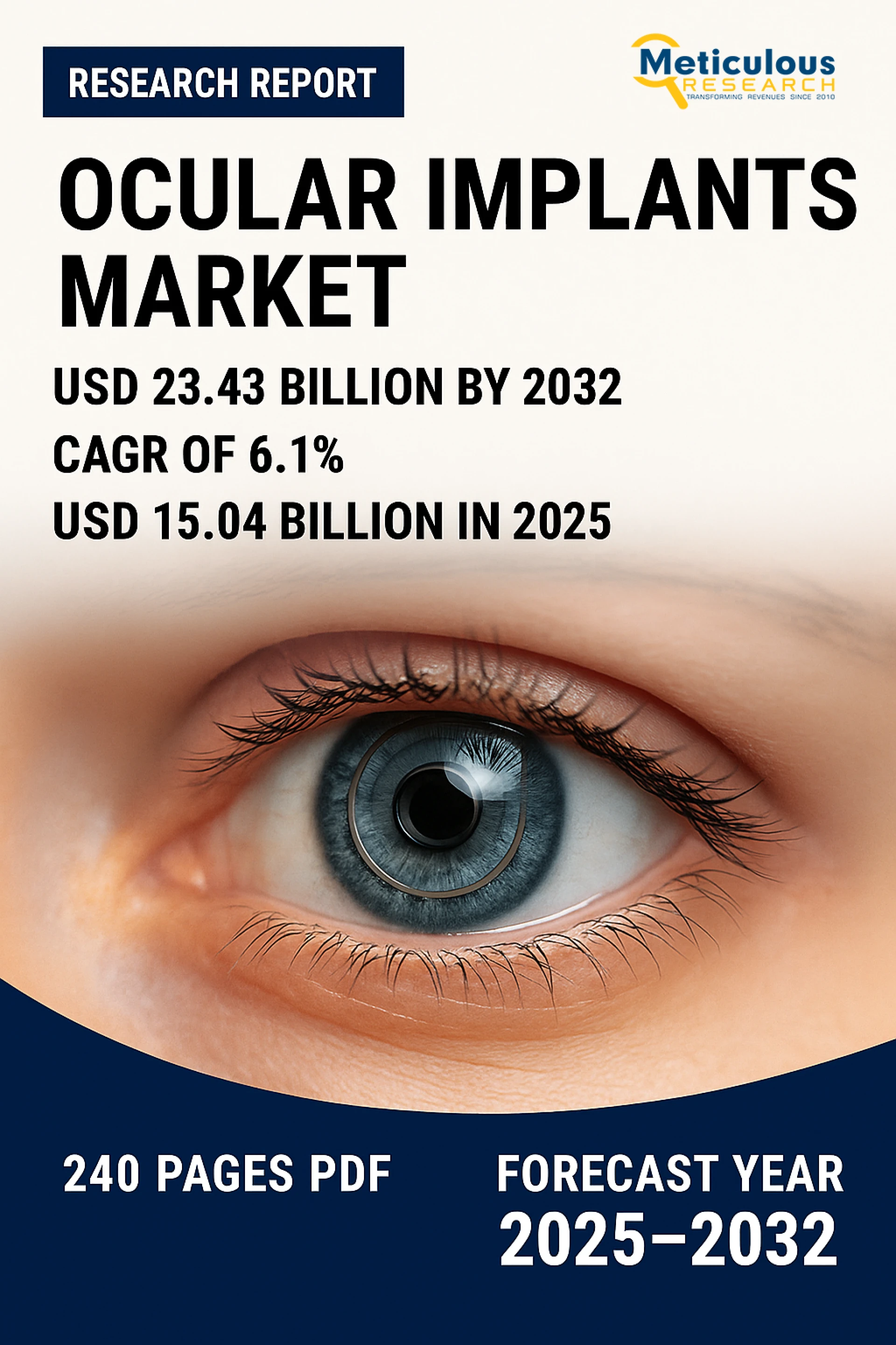 Ocular Implants Market Size, Share, Forecast, & Trends Analysis