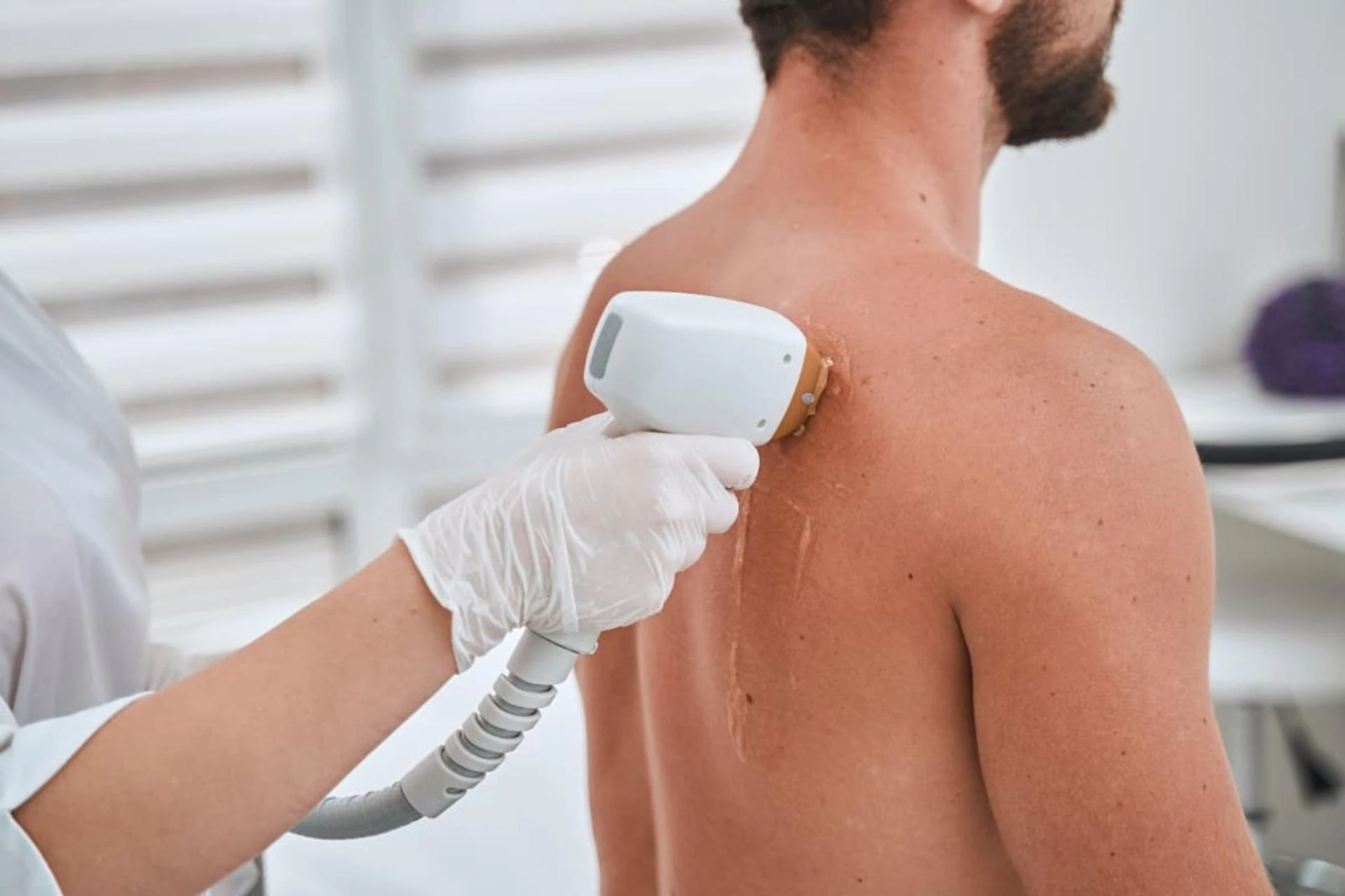 Is Men’s Laser Hair Removal Safe for Sensitive Skin