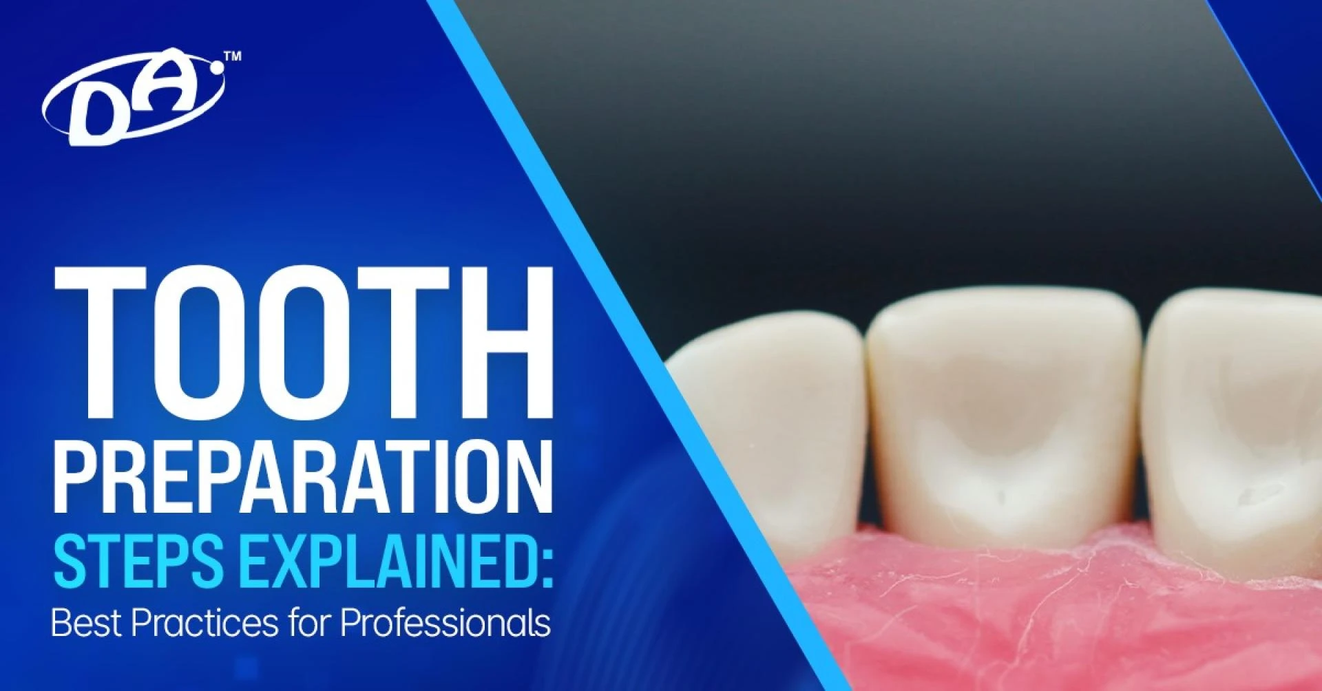 Tooth Preparation Steps Explained: Best Practices for Professionals