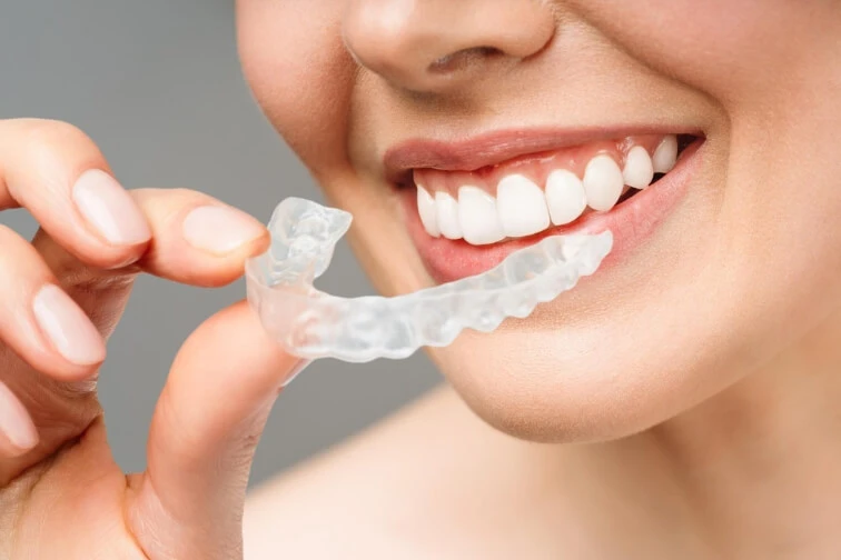   How The Smiler Clear Aligners Work?