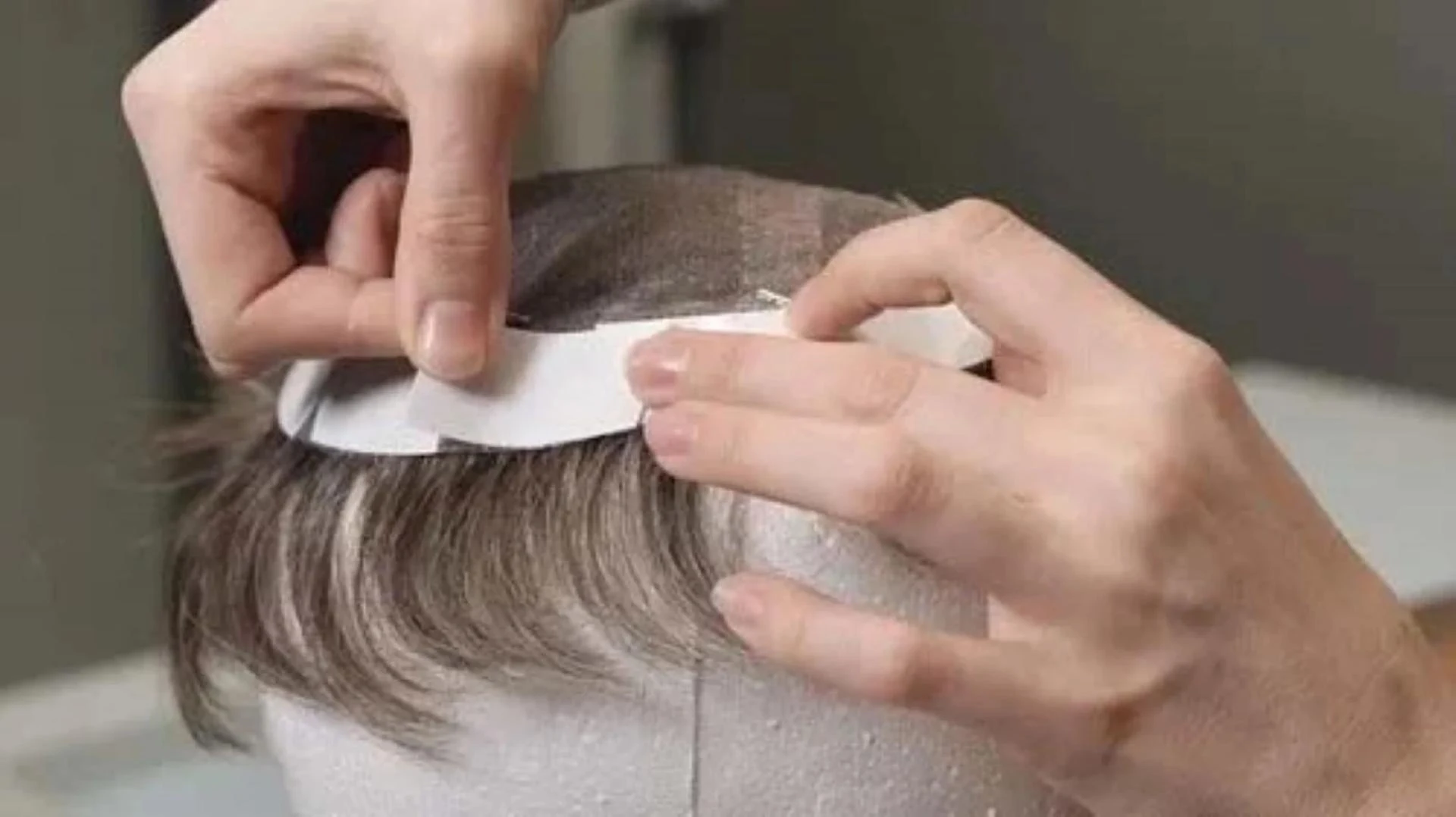 Losing Hair? Here’s Why Hair Patch in Bhopal Could Be Your Best Fix?