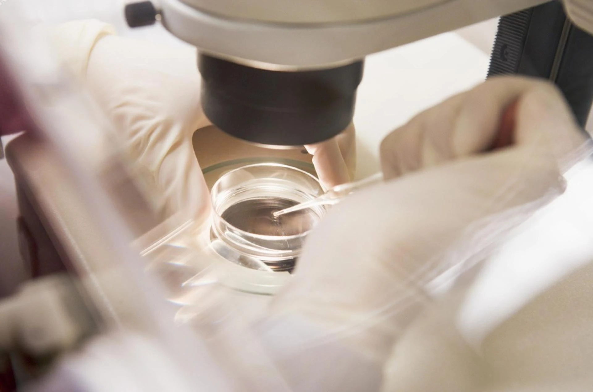 PGD and Gender Selection in Lahore: Advancing Fertility Choices for Families