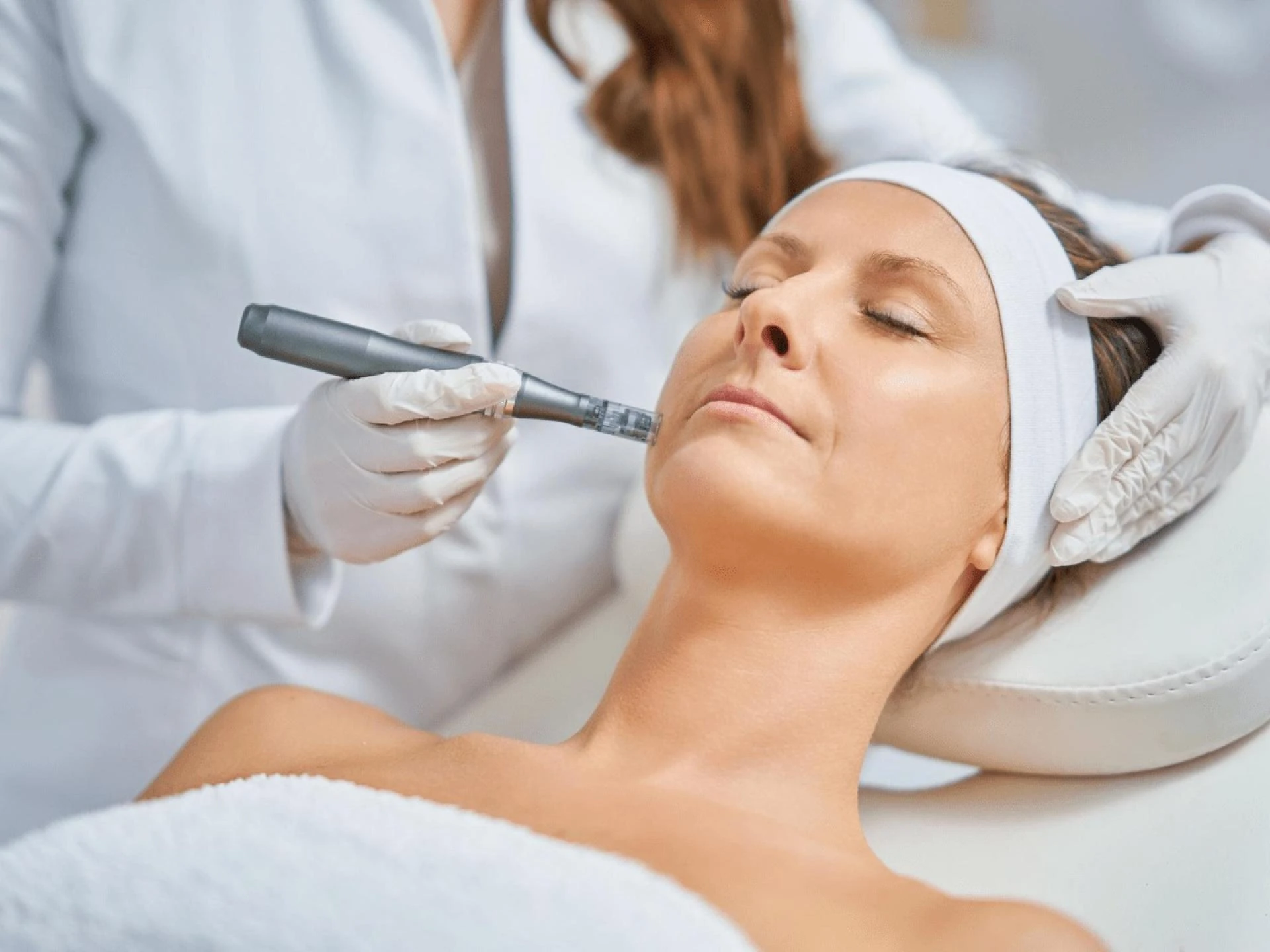 Microneedling Aftercare and Healing: Expert Advice for Radiant Skin