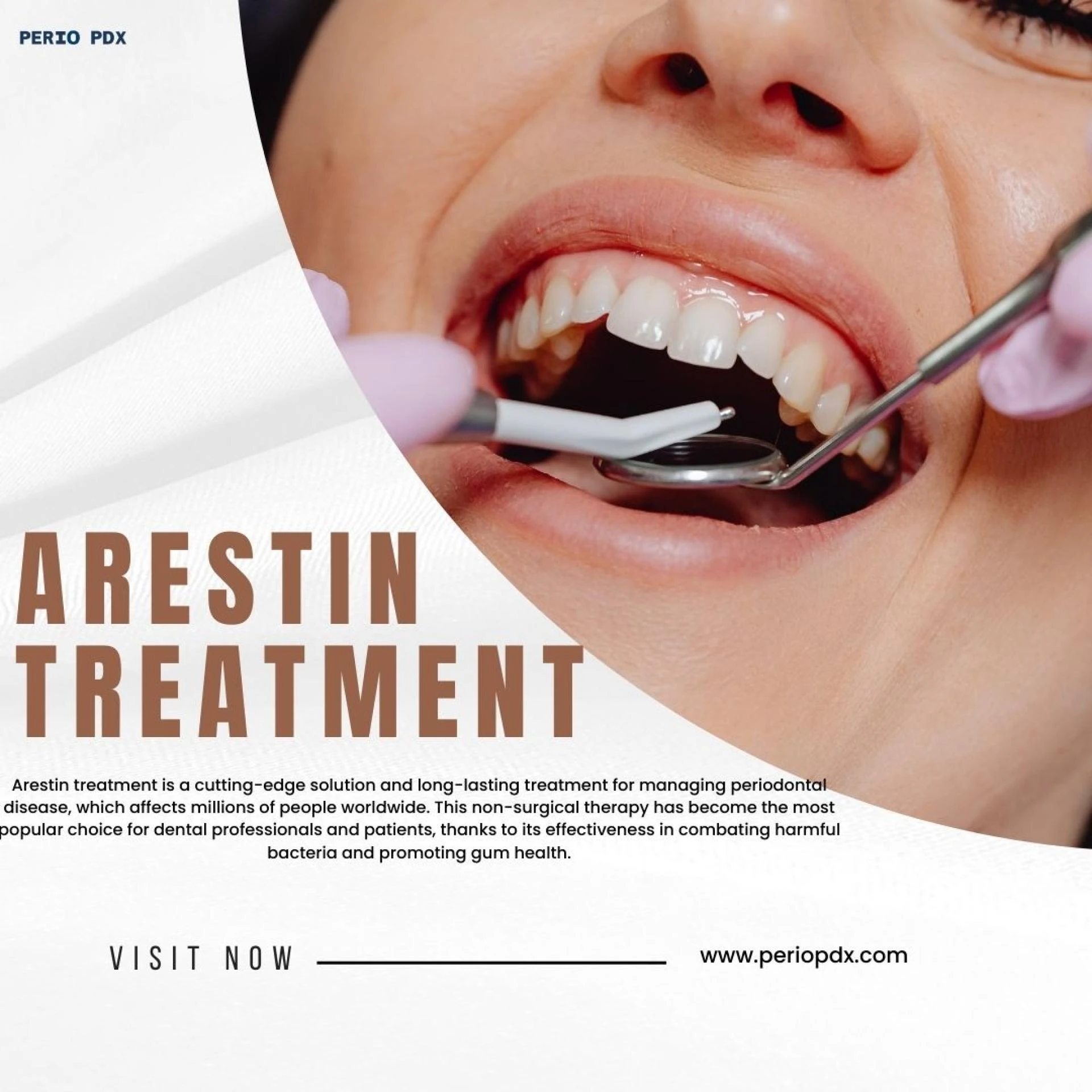 What Is Arestin Treatment and How Does It Work?