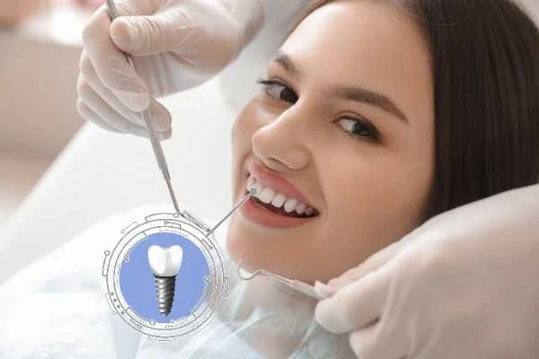 On the Spot Dental Help with Experienced Implant Treatments