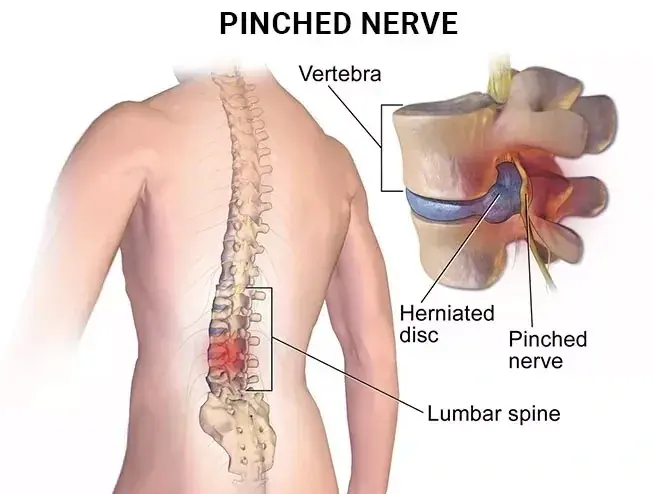 Best Chiropractor in Dubai for Lower Back Pain