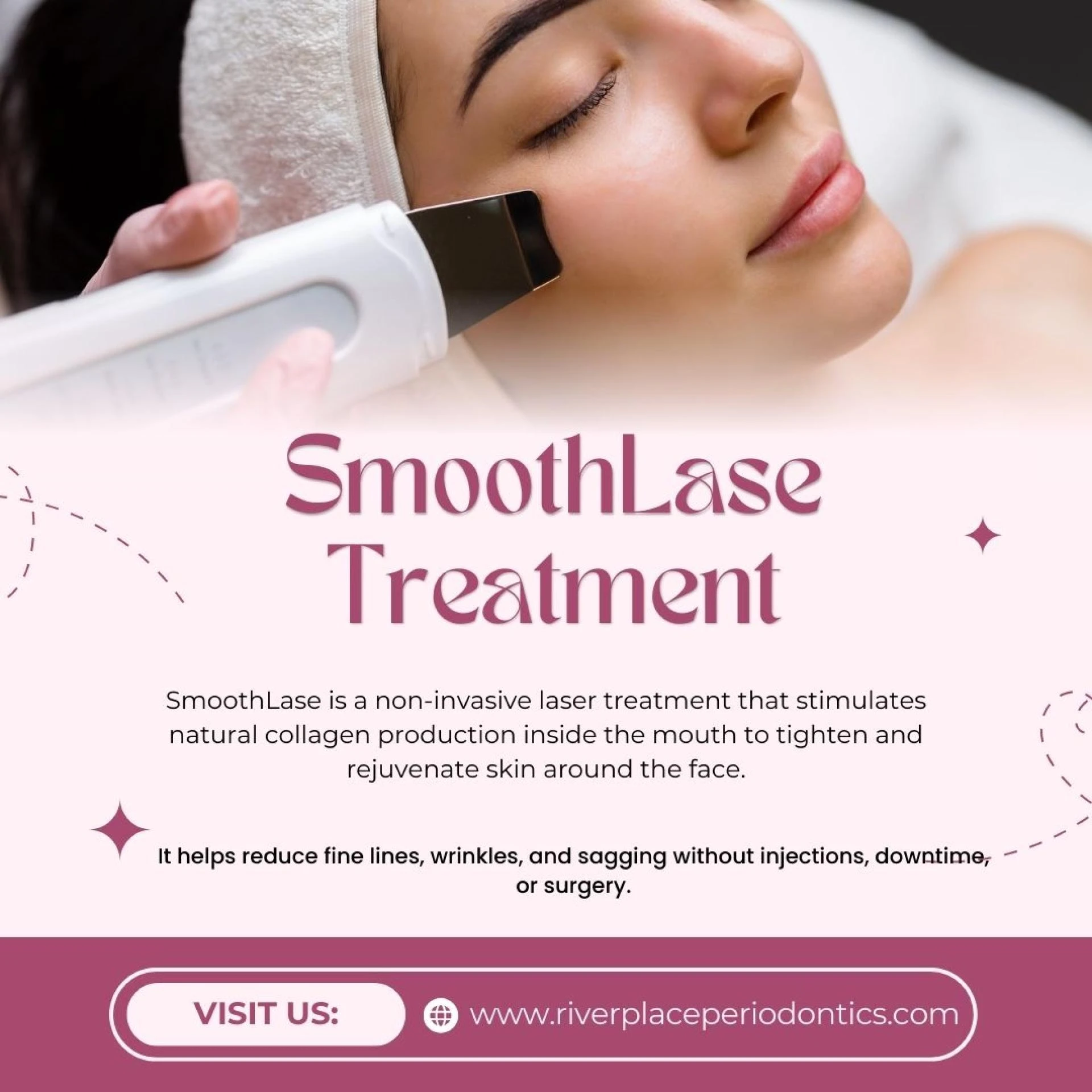 What Is SmoothLase Treatment? Is SmoothLase Right for You