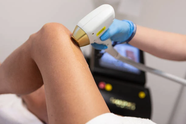 Laser Hair Removal in Dubai: Cost Breakdown and Affordable Options