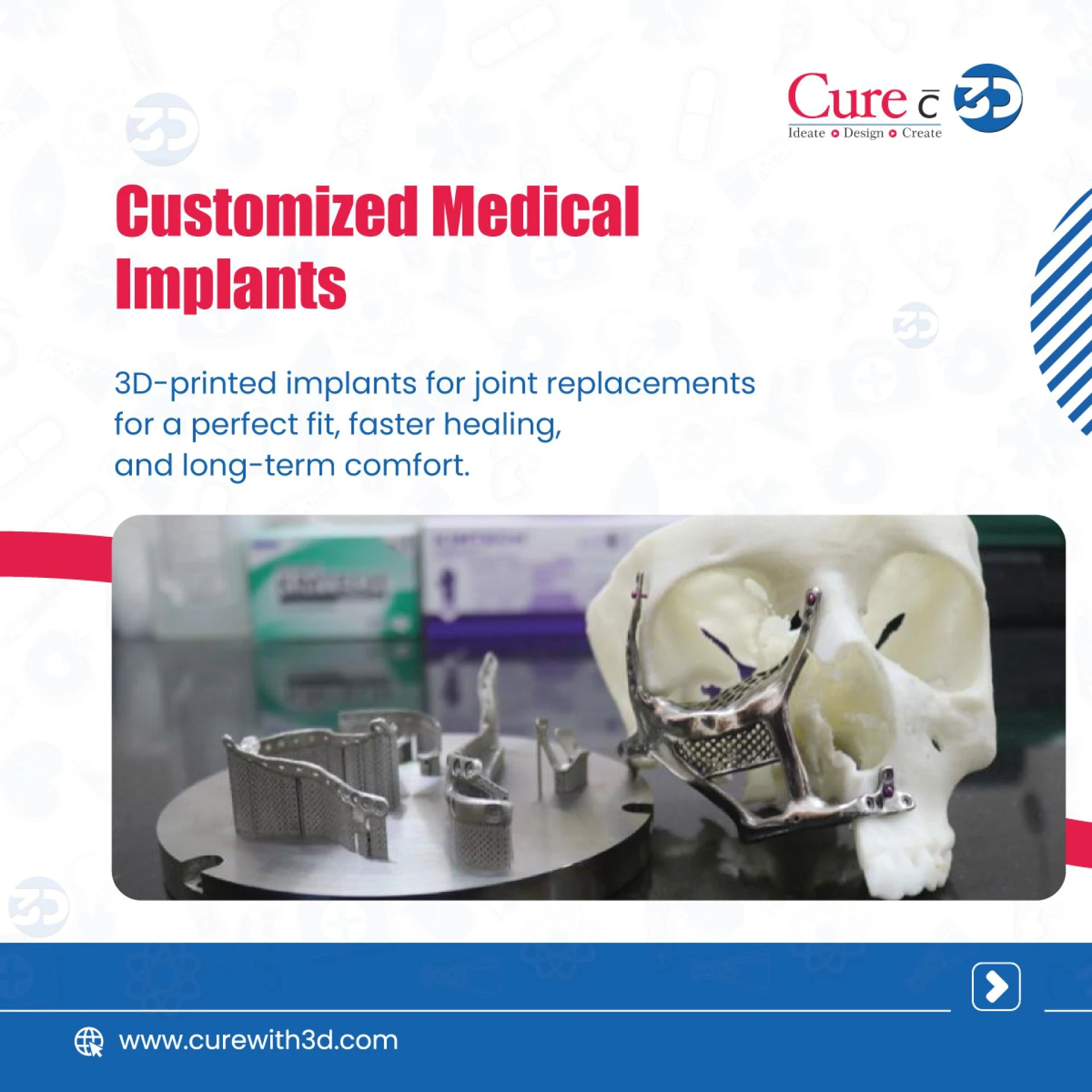 Why 3D Printed Implants Are the Future of Orthopedics and Dentistry?