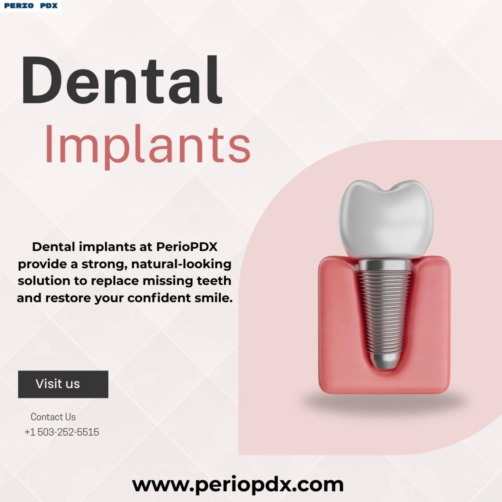 Are Dental Implants Painful? Myths vs. Reality