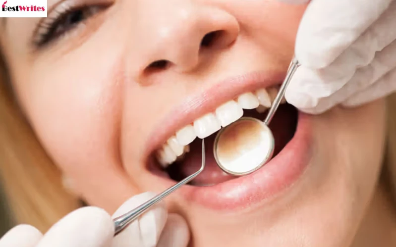 Dental Cleaning Without Insurance: Average Cost & Budget Options | Best Writes Links