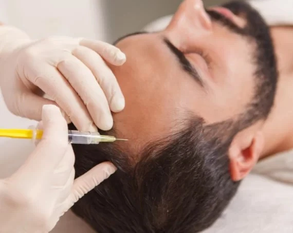 PRP Injections for Hair Growth in Dubai: What to Expect