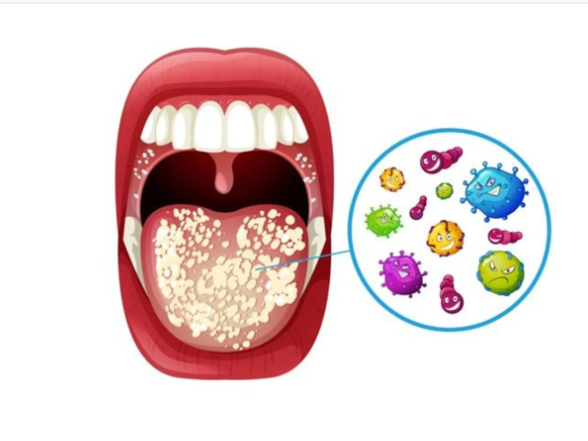 How Smoking and Tobacco Affect Your Teeth and Gums