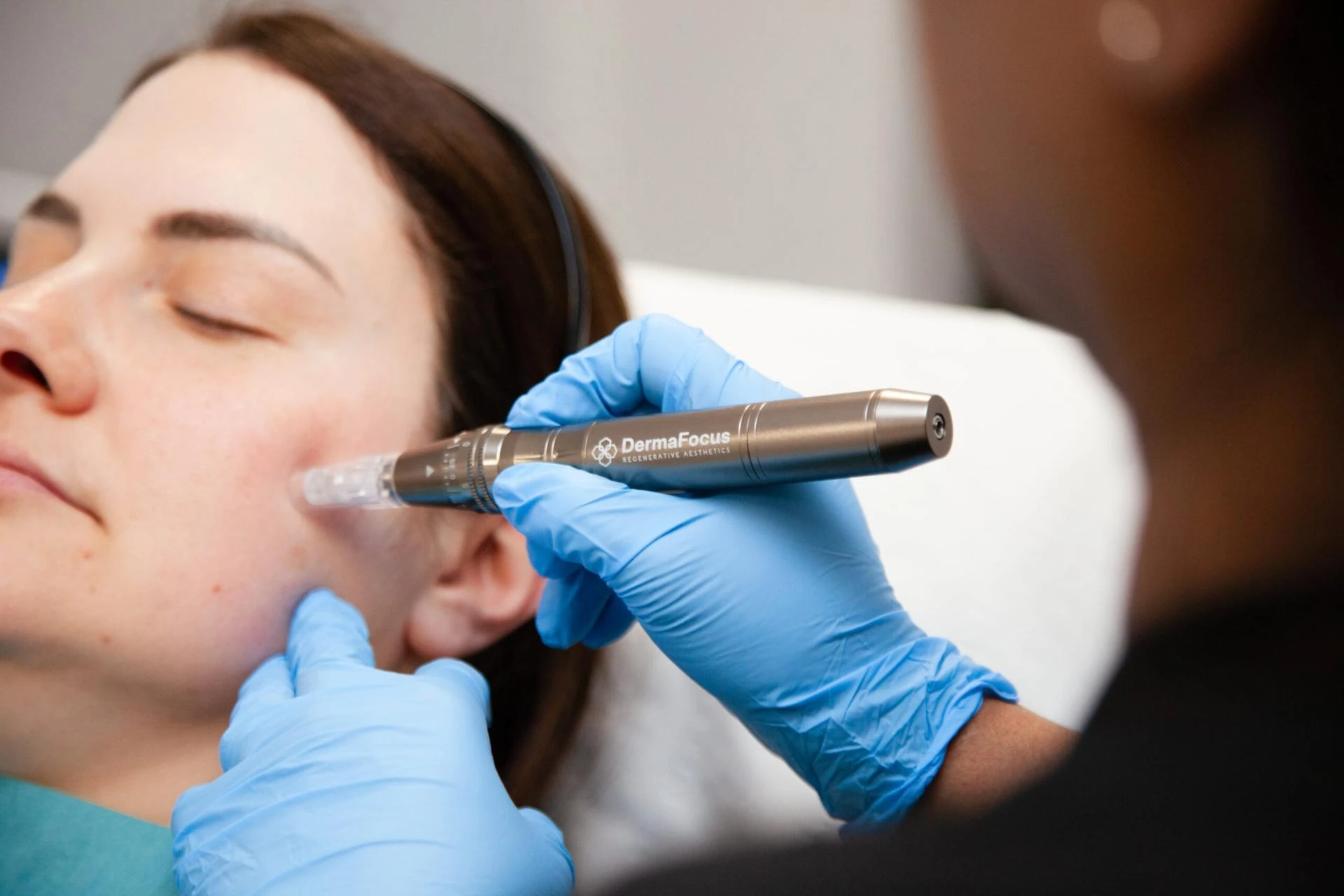 Exosome Therapy in Dubai: The Future of Skin and Hair Rejuvenation