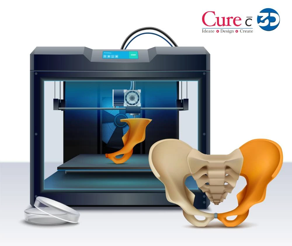 How 3D Printed Custom Surgical Cutting Guides Contribute to Partient Safety?