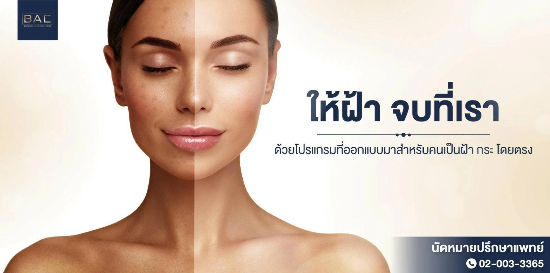 Effective and Safe Melasma Treatment with Picosecond Laser at BAC Clinic, Bangkok Post Title