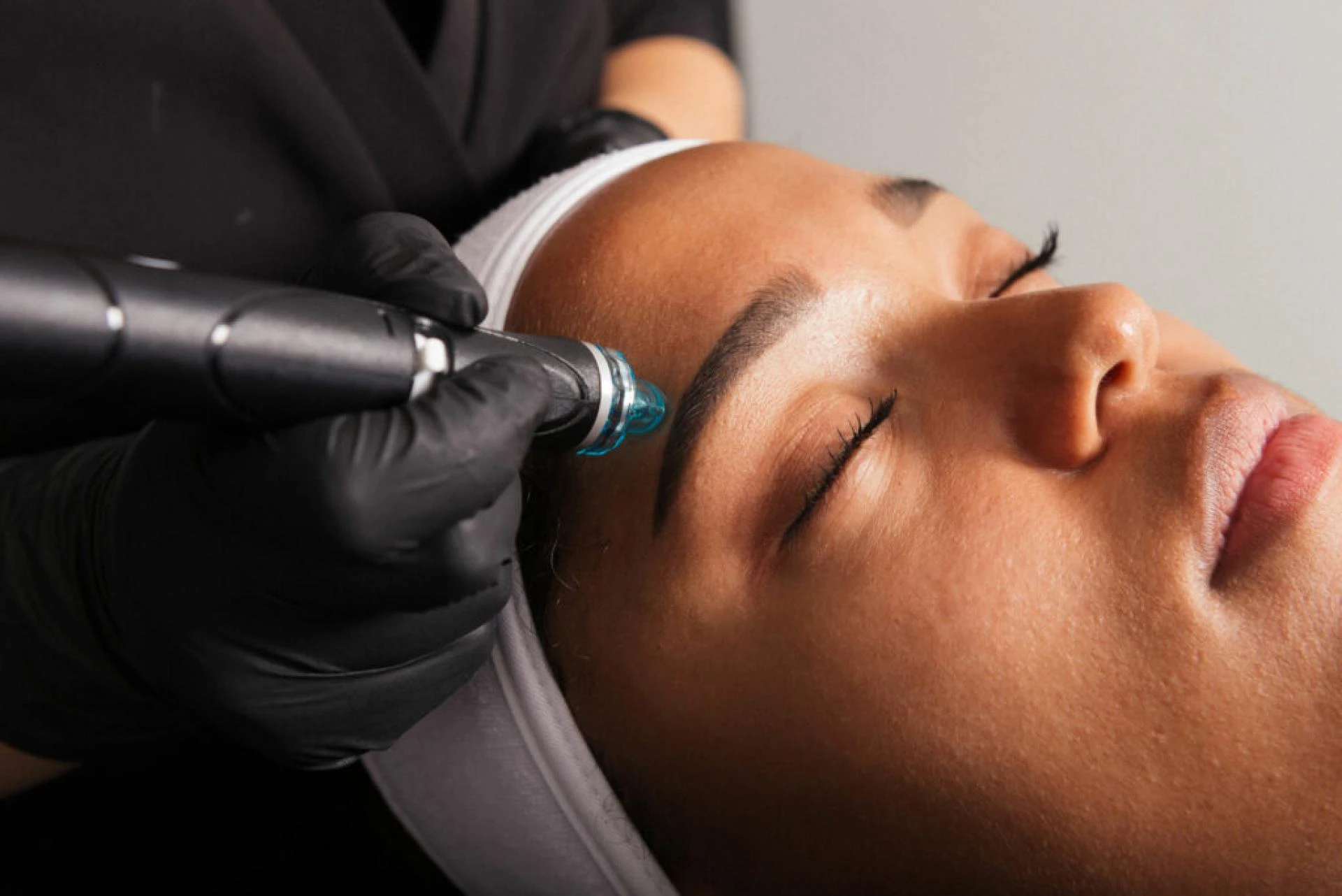 How HydraFacial Helps Reduce Fine Lines and Wrinkles
