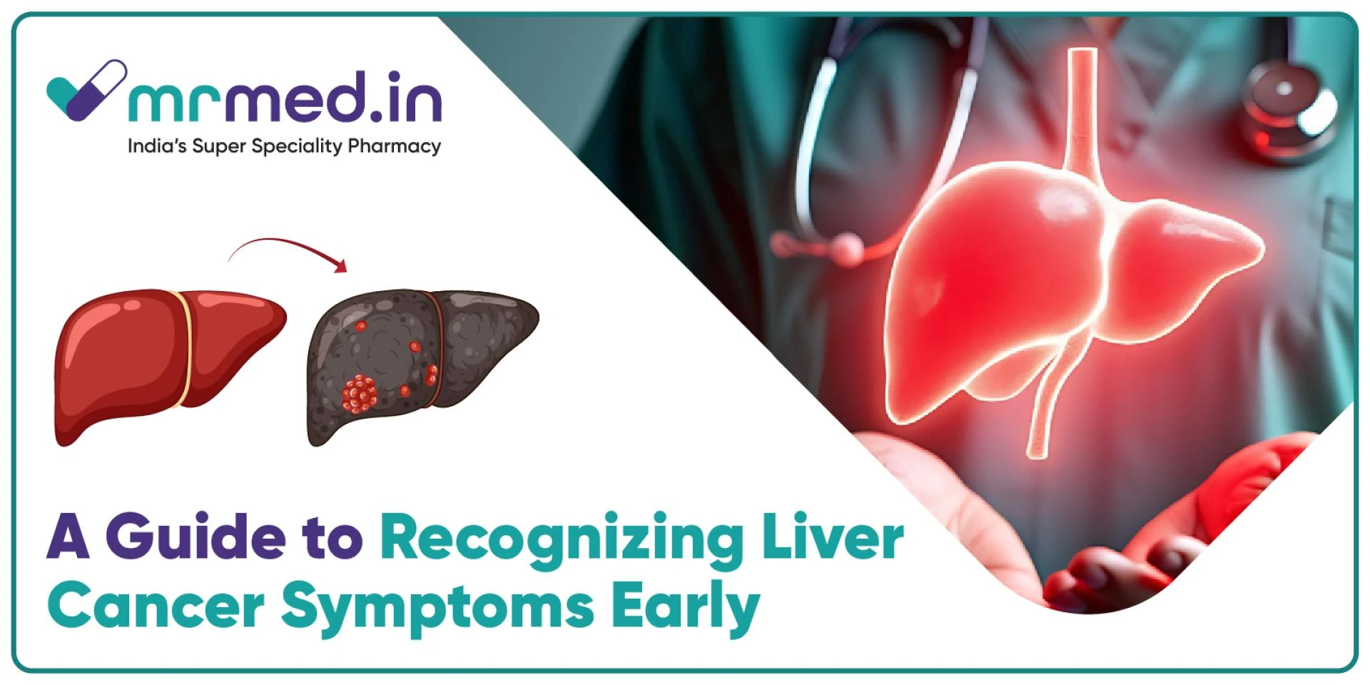 Early Signs of Liver Cancer Everyone Should Know
