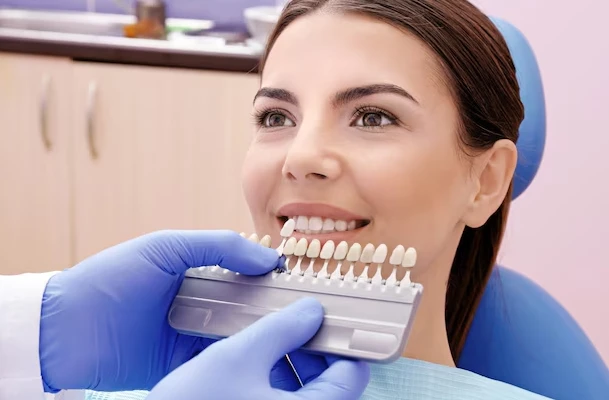 Dental Veneers Explained: Preparation, Placement, Maintenance and Benefits