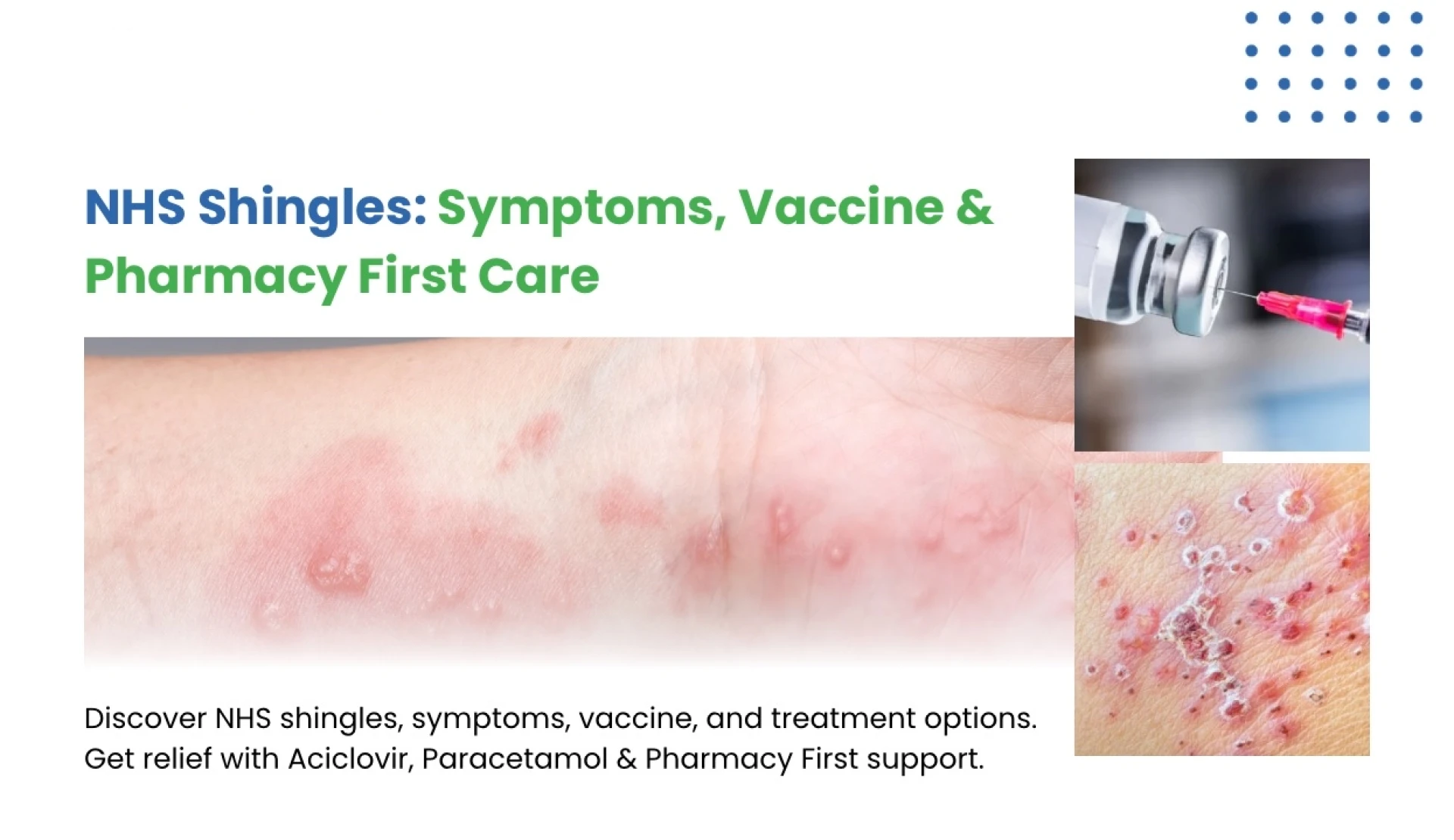 Who Qualifies for the Shingles Jab NHS? Key Details