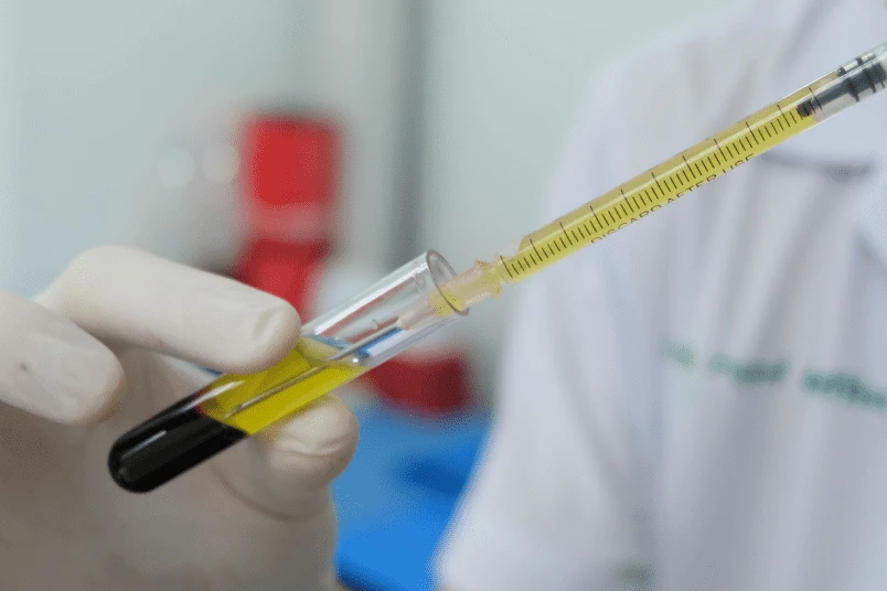 P-Shot Therapy In Pakistan - Complete Guide