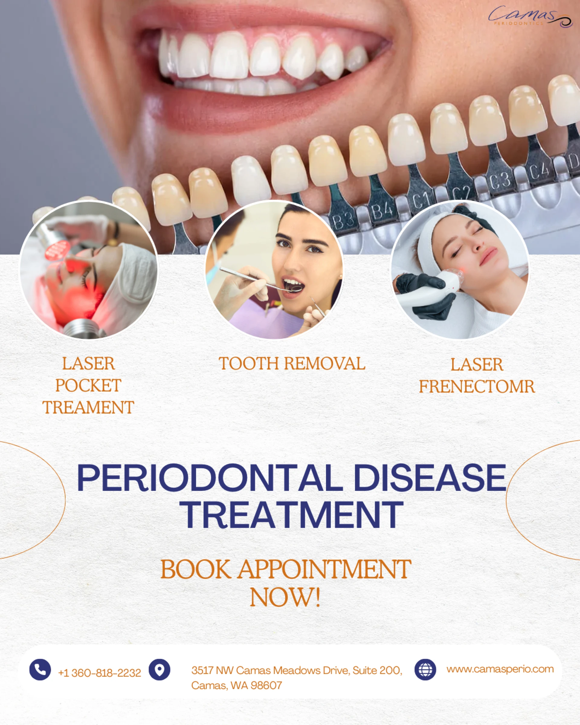 What Is Periodontal Disease Treatment ?