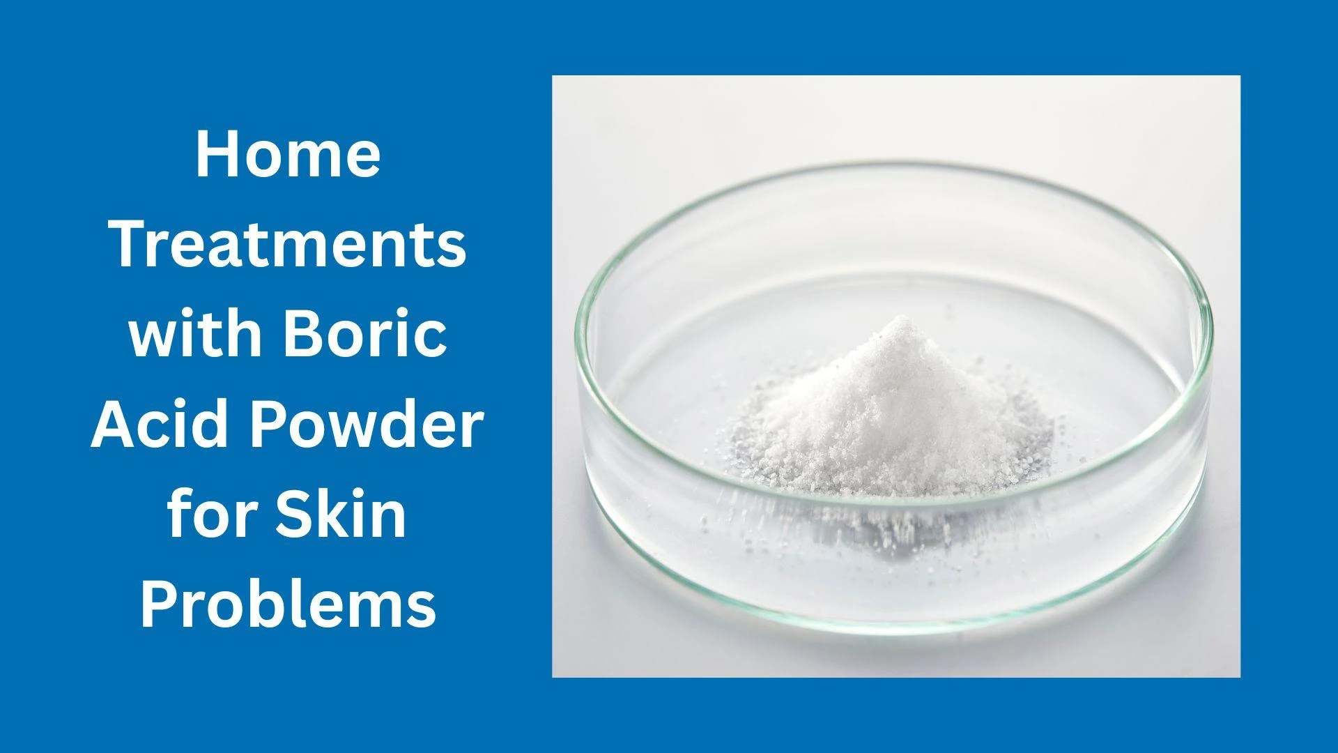 Home Treatments with Boric Acid Powder for Skin Problems
