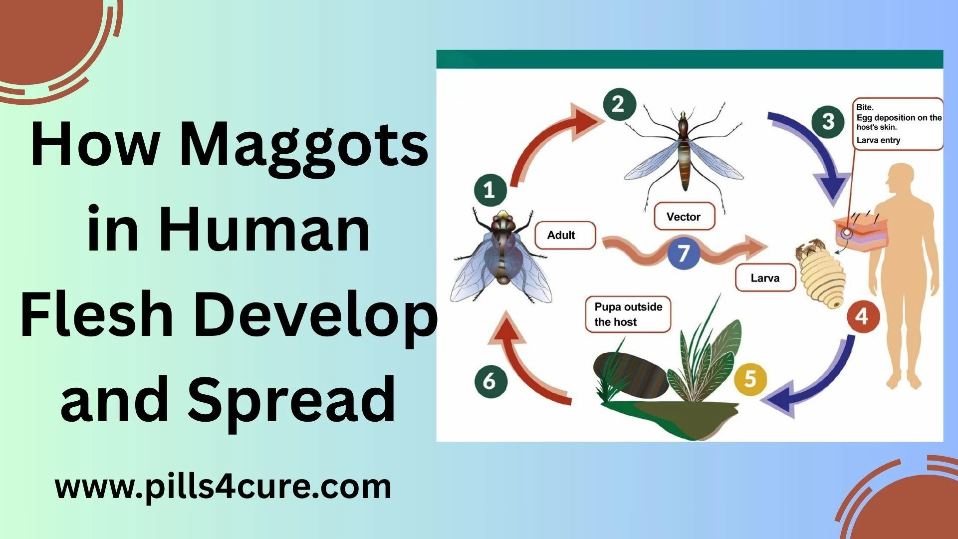 How to Kill Maggots in Humans: Essential First Aid and Medical Options