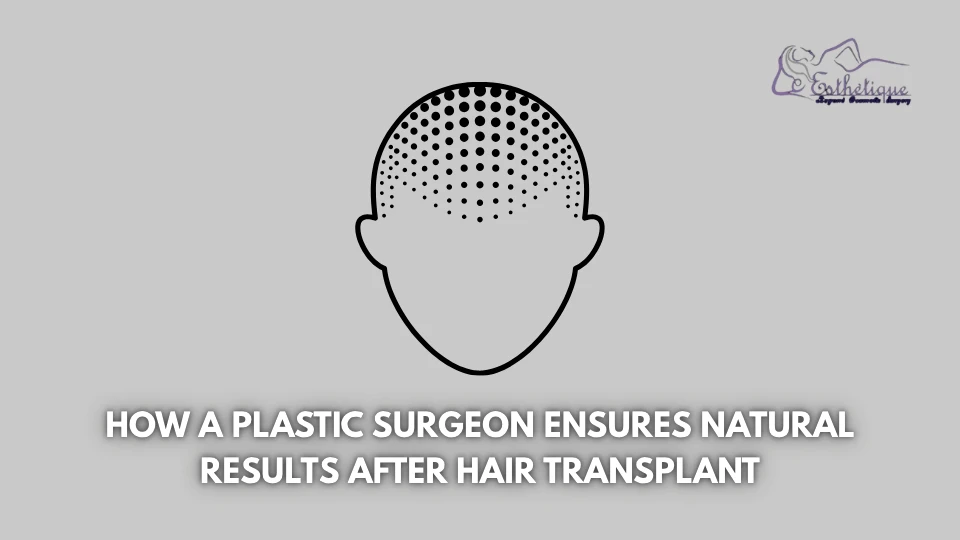 How a Plastic Surgeon Ensures Natural Results After Hair Transplant