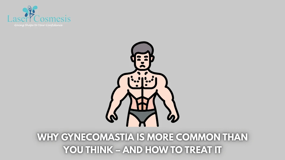 Why Gynecomastia Is More Common Than You Think – And How to Treat It