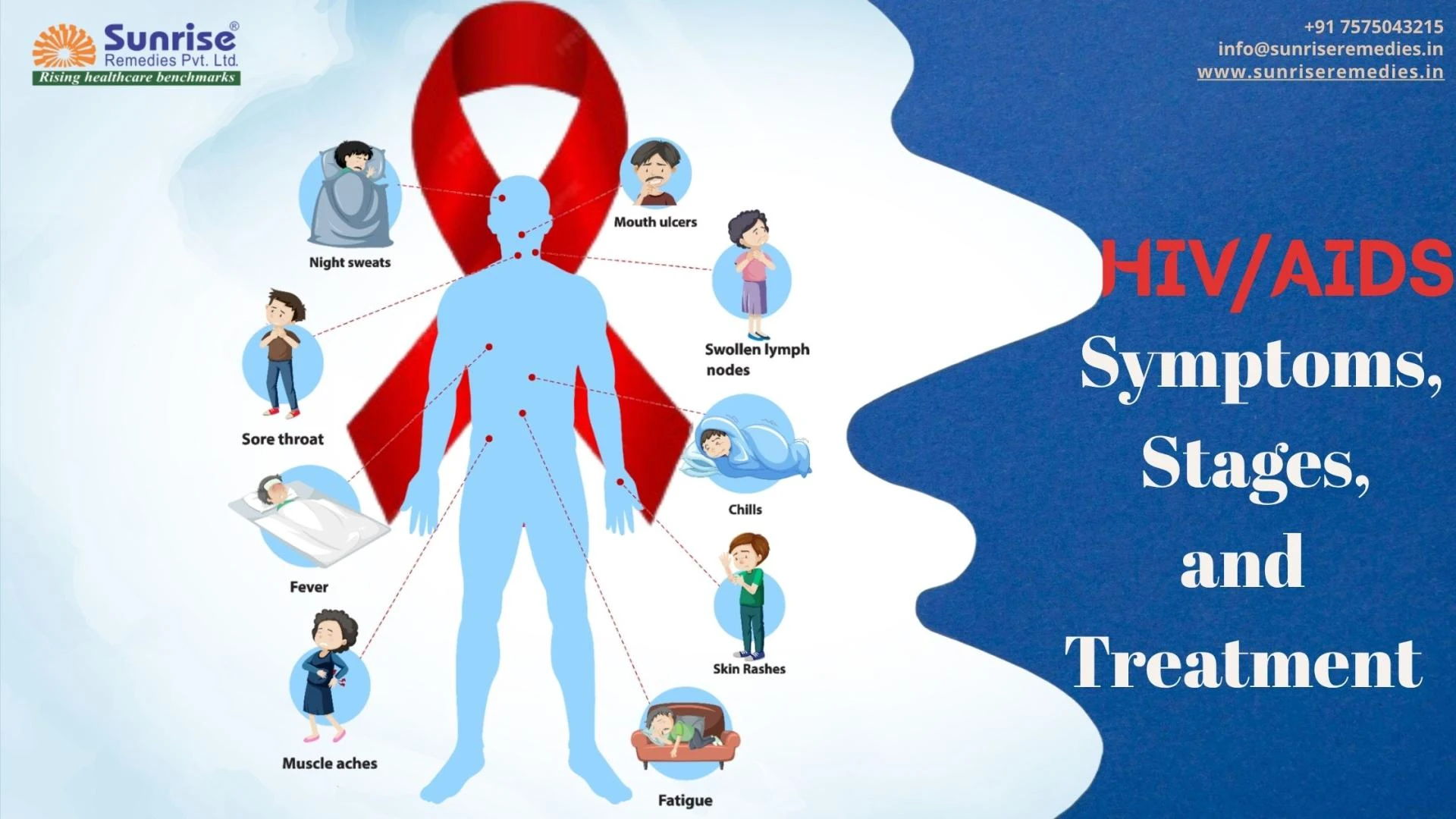 HIV/AIDS: Symptoms, Stages, and Treatment