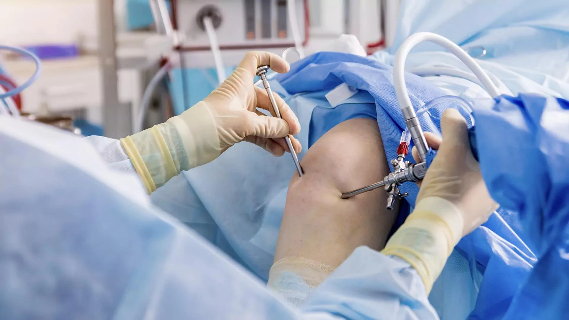 Arthroscopic Surgery In Delhi : Purpose, Procedure, Benefits, Cost & Recovery
