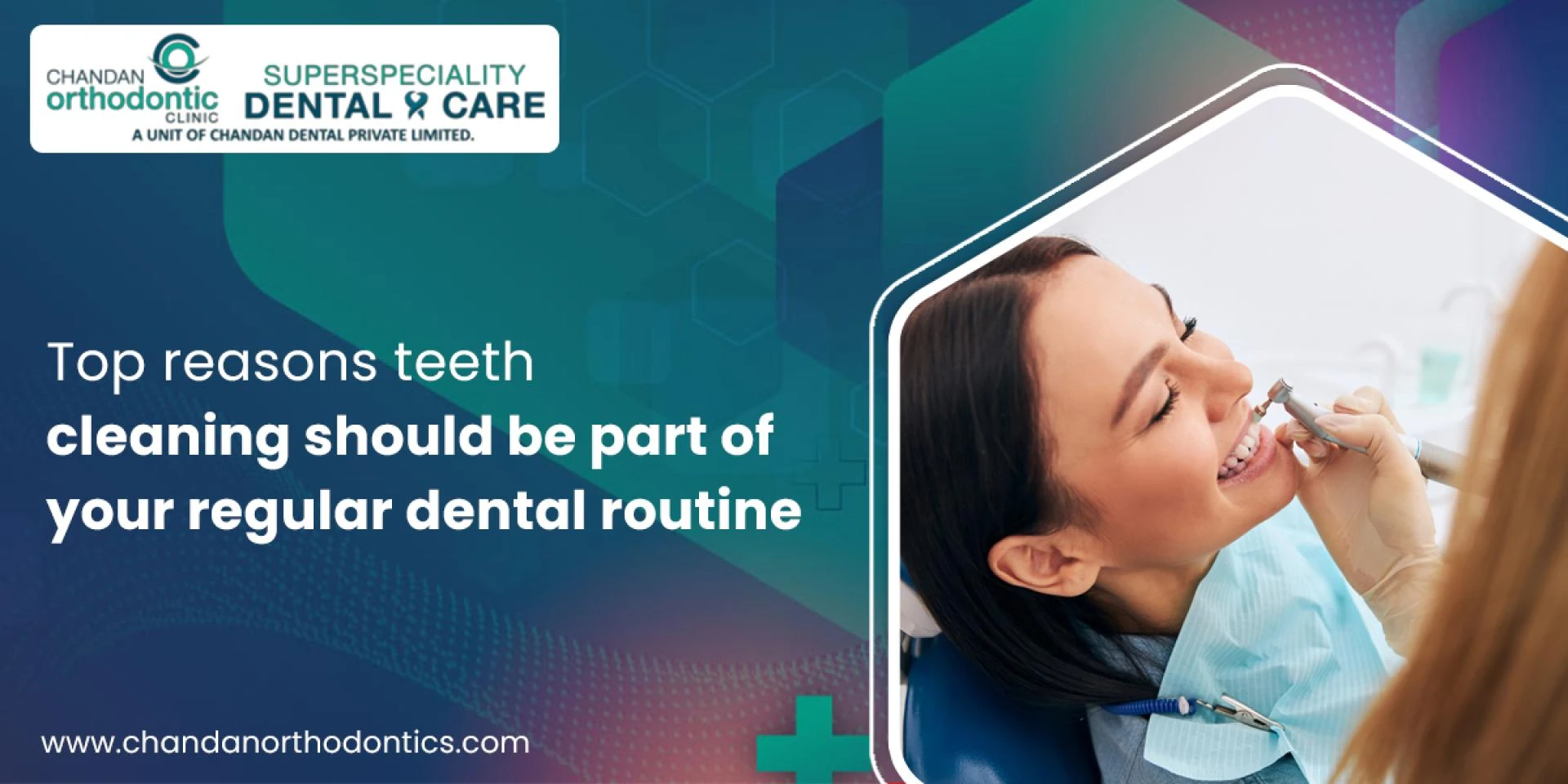 Top reasons teeth cleaning should be part of your regular dental routine