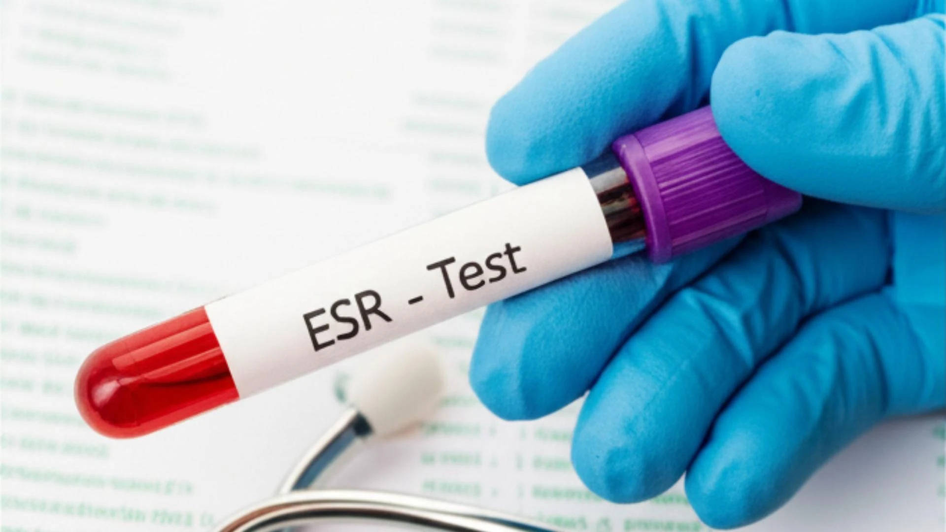 ESR Test Price, Purpose, Procedure, and Results