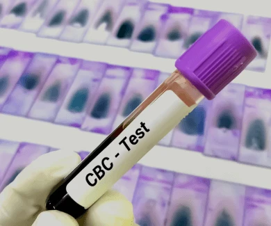 CBC Test in Noida: Purpose, Price, and Benefits