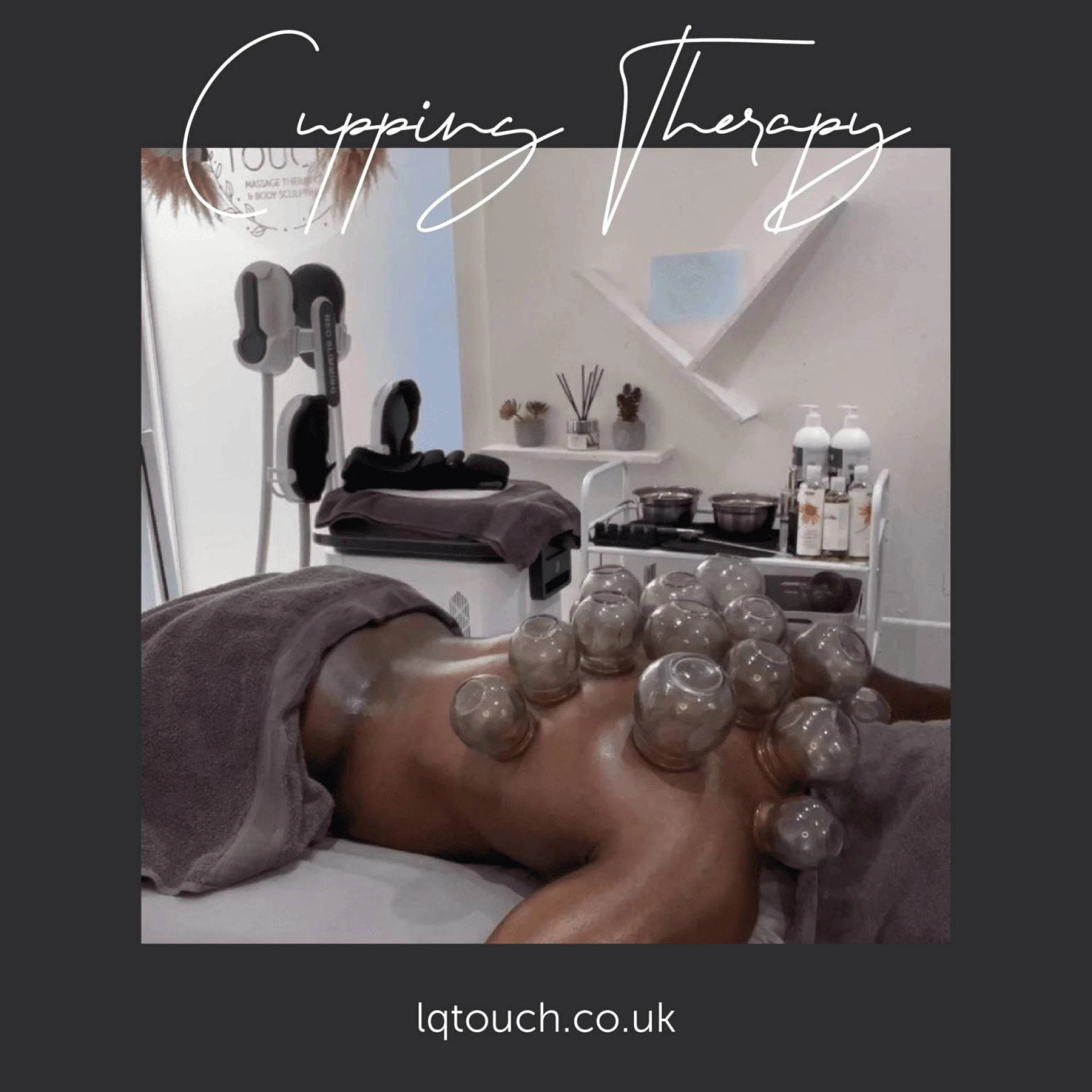 Top 5 Reasons to Try Cupping Therapy in Bromley Today