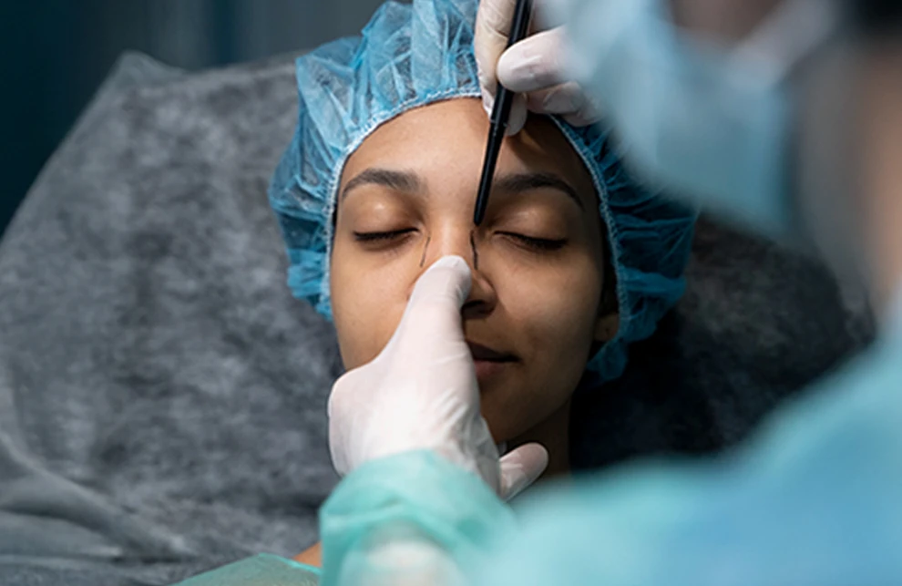 Choosing the Right Rhinoplasty Surgeon in Whitefield, Bangalore