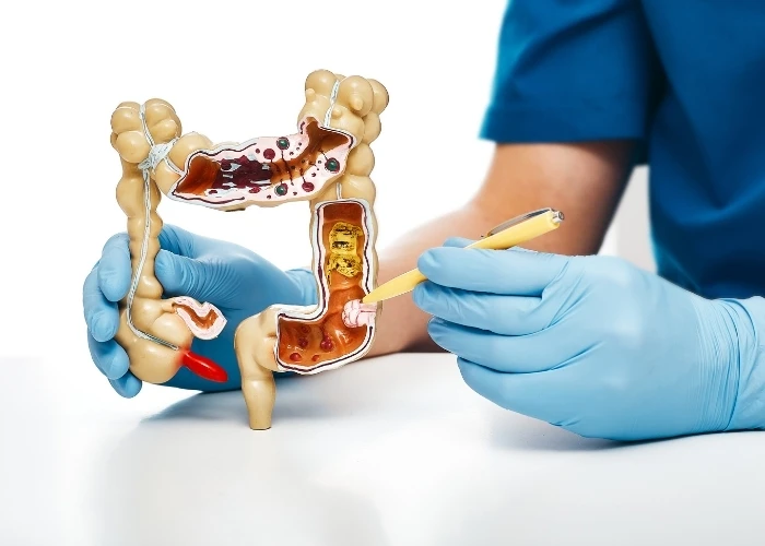 Gastritis Care Near Me Houston | Curative Digestive Disease Center