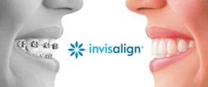 Why Some Invisalign Users Notice Weight Loss During Treatment