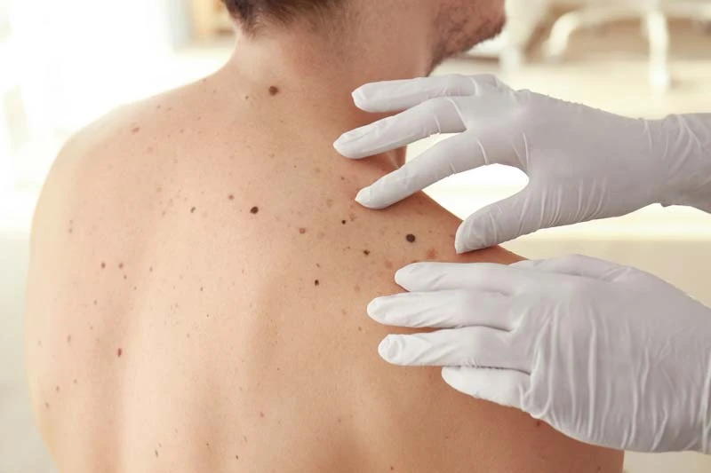 Expert Care for All Skin Types: Dermatologist in Fort Worth, TX, Aledo & North Richland Hills