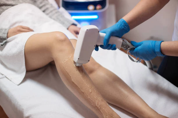 Can Laser Hair Removal in Riyadh Help with Ingrown Hairs?