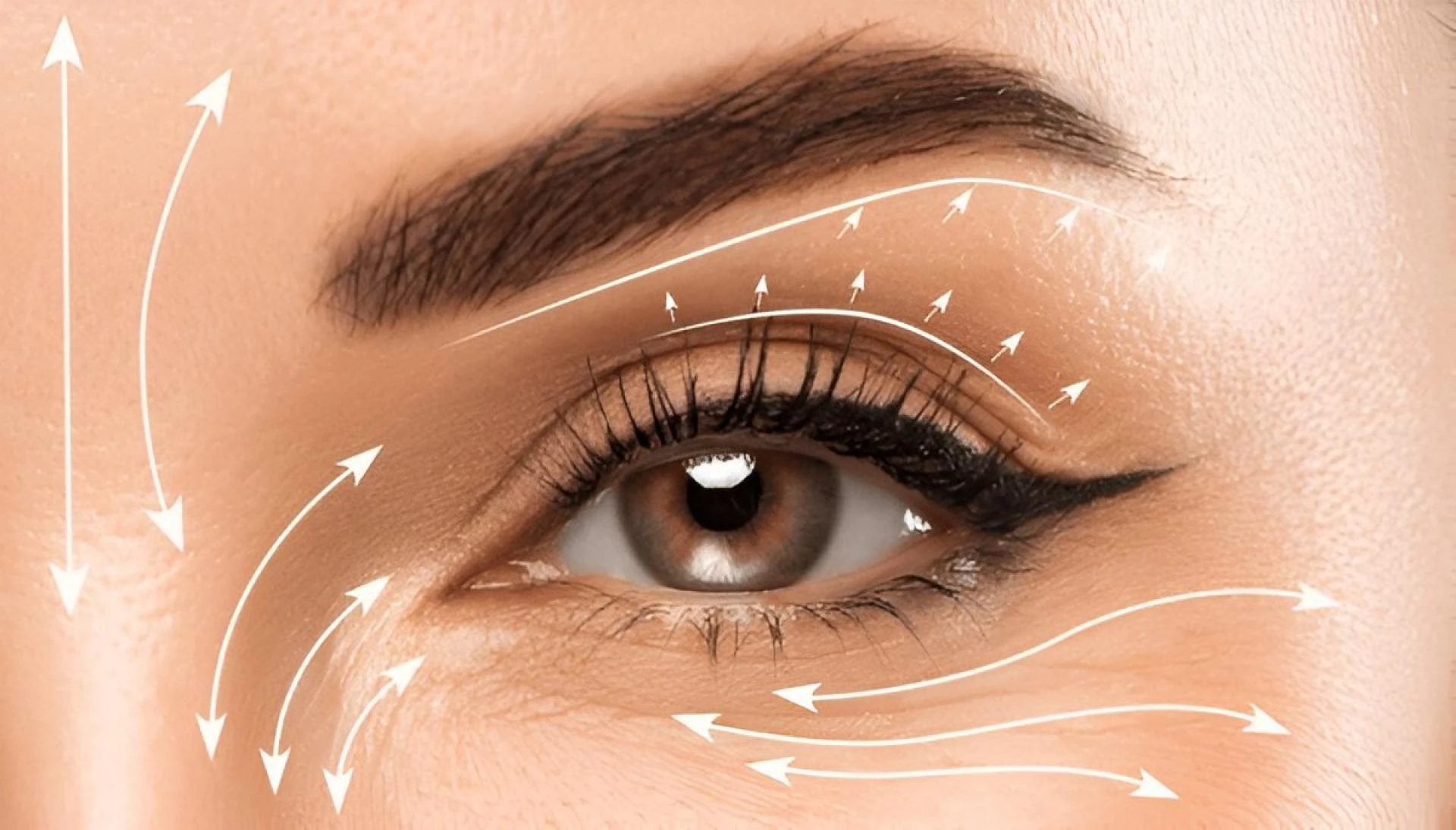 Upper vs. Lower Blepharoplasty: Which One Do You Need?