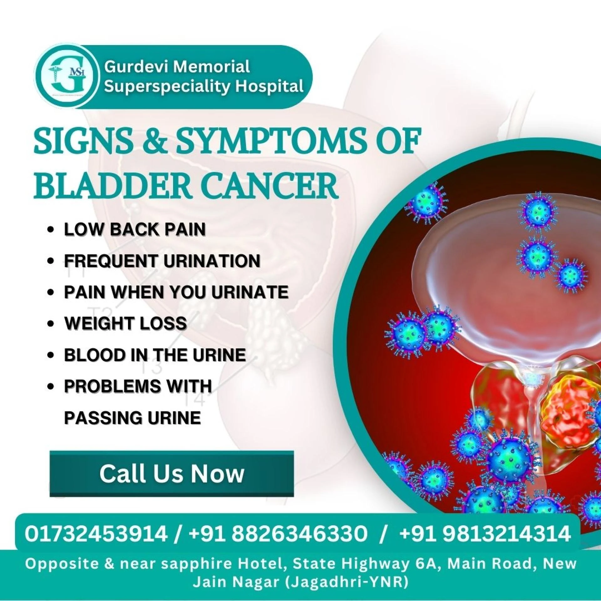 Where Can I Get the Best Bladder Cancer Treatment in Yamunanagar?