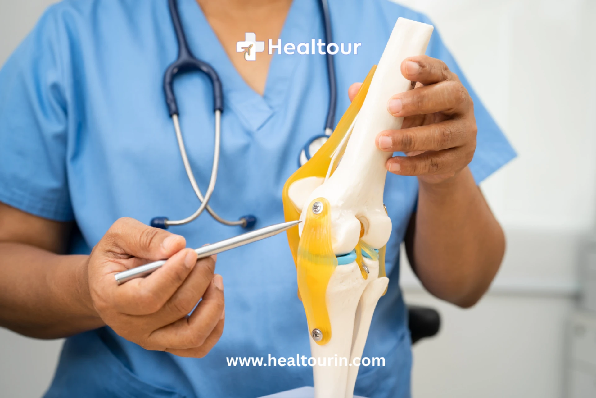 Cost of Knee Replacement Surgery in India (2025): A Complete Guide for International Patients