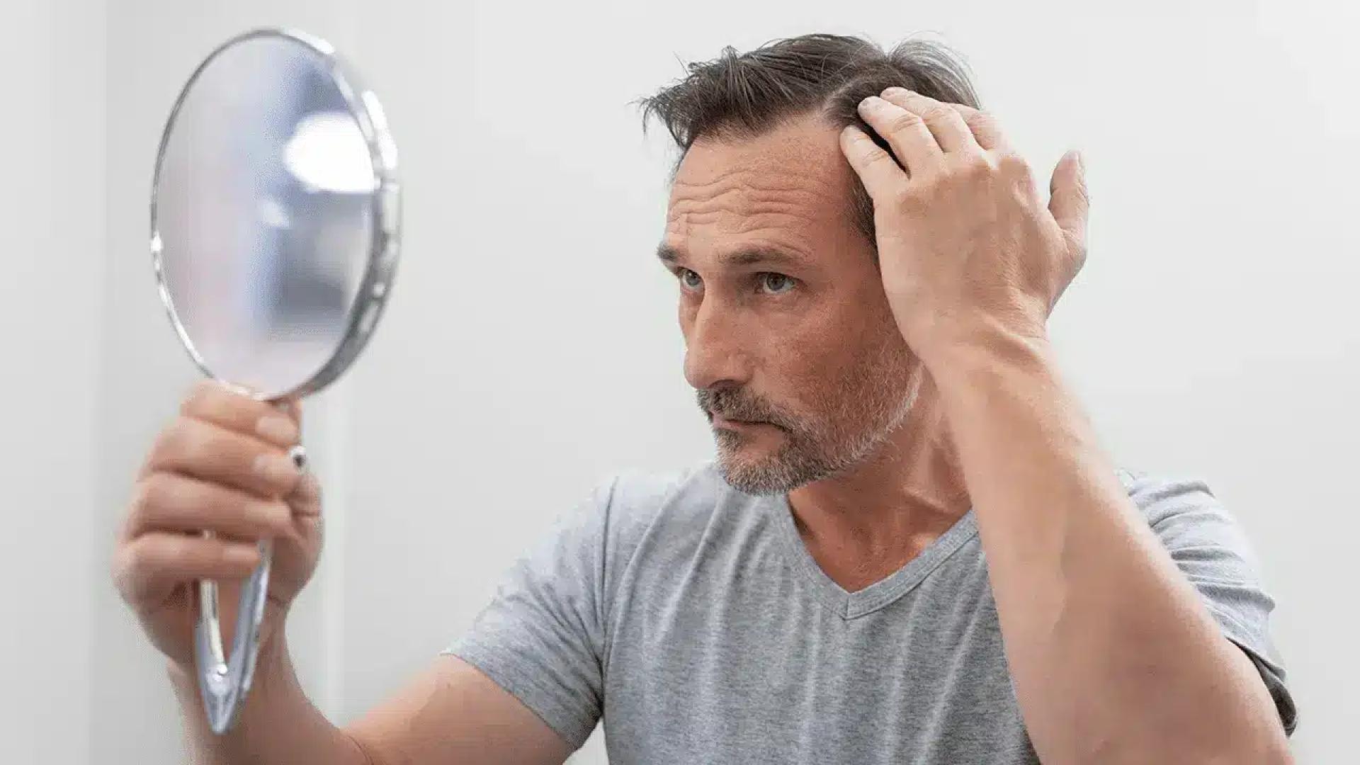 Haarverzorging na de 40: Hoe Je Haaruitval in de Middelbare Leeftijd Aanpakt